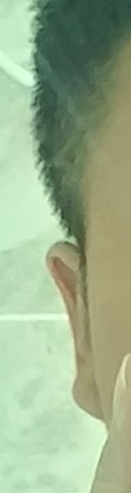 第二点提到的，注意到这里特别剧烈的转折